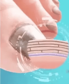 Spray Anti Hongos – Con Veneno de Abeja Natural 🐝