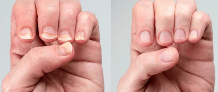 Spray Anti Hongos – Con Veneno de Abeja Natural 🐝