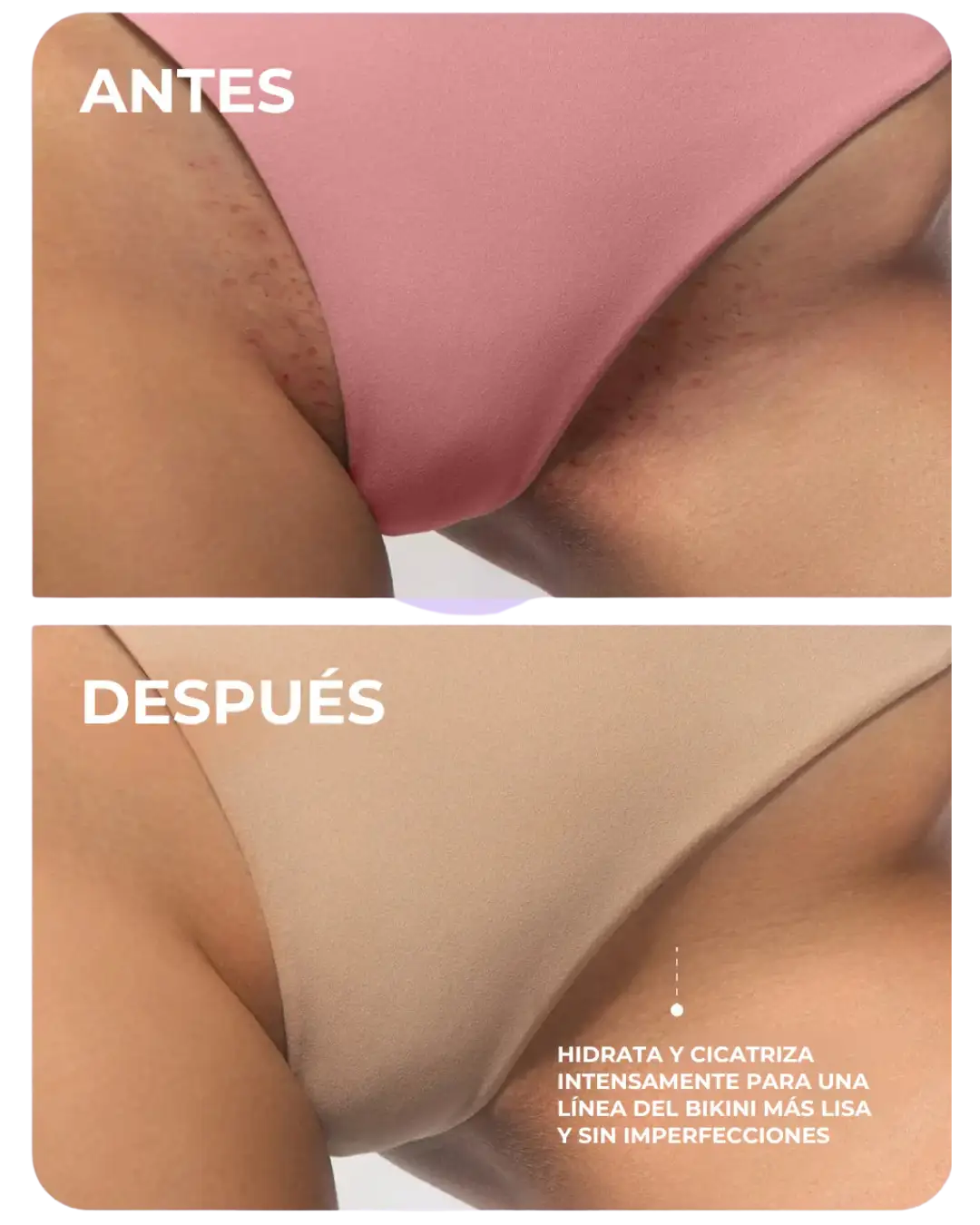 Piel íntima más clara y fresca